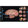 3D Organon VR Anatomy for your Standalone VR headset | Standard